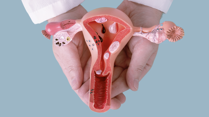 https://ru.freepik.com/premium-photo/doctor-gynecologist-holds-model-female-reproductive-system-hands-help-care-concept_30431437.htm#fromView=search&page=3&position=10&uuid=64d20b0a-00f5-4d58-8600-bea1f1edadce&query=%D1%88%D0%B5%D0%B9%D0%BA%D0%B0+%D0%BC%D Научно-практическая школа «Цервикология — от азов к практическому опыту»