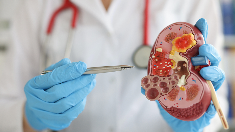 https://ru.freepik.com/premium-photo/doctor-hospital-is-standing-holding-anatomical-model-kidney_36955842.htm#from_element=cross_selling__photo Семинар «Тактика ведения пациентов с ХБП на диализе и гиперфосфатемией: новые знания и клинический опыт»