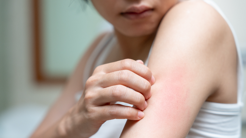 Вебинар «Академия вирусных дерматозов»