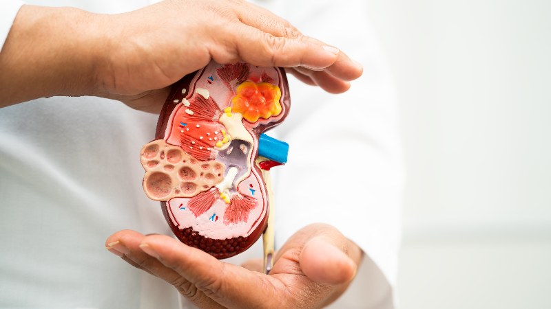 Семинар «СЗ — гломерулопатия и первичный ИК-МПГН: современный взгляд на проблему, вопросы диагностики и терапевтические подходы»