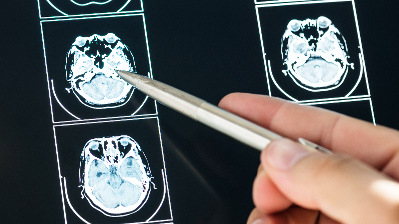 Научно-практическая конференция «Персонализированное лечение неврологических заболеваний»