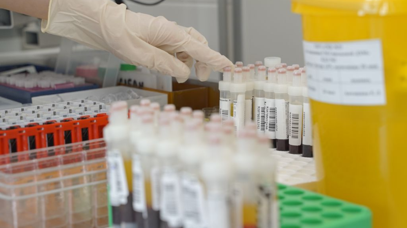 Вебинар «Евразийская школа токсикологов. Применение ЭКМО в токсикологической практике»